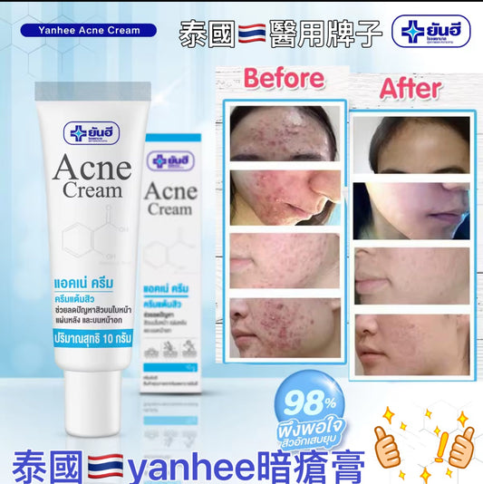 泰國🇹🇭yanhee 醫用 祛痘膏 針對暗瘡 痘痘 痤瘡問題的人
