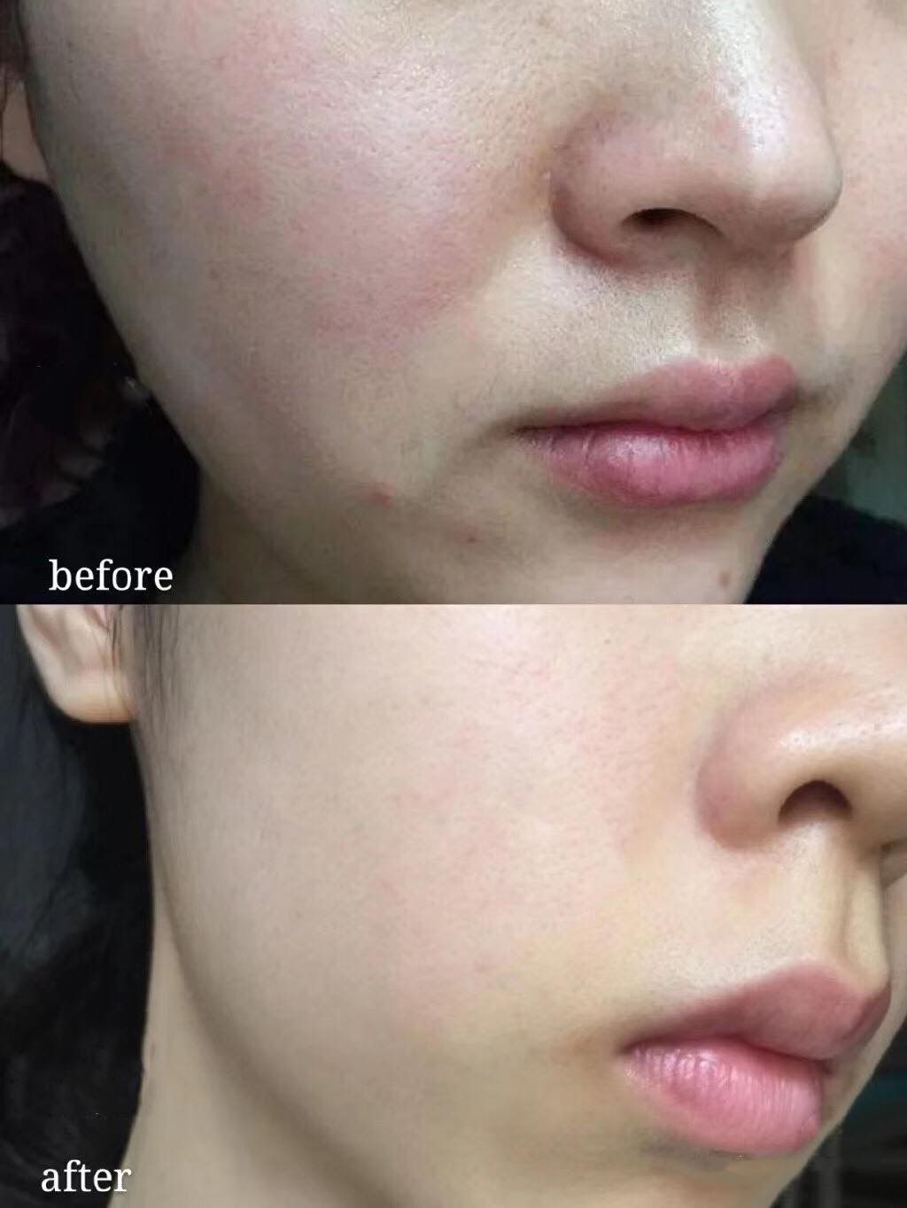 泰國🇹🇭寶貴黃金24K美白修復精華液