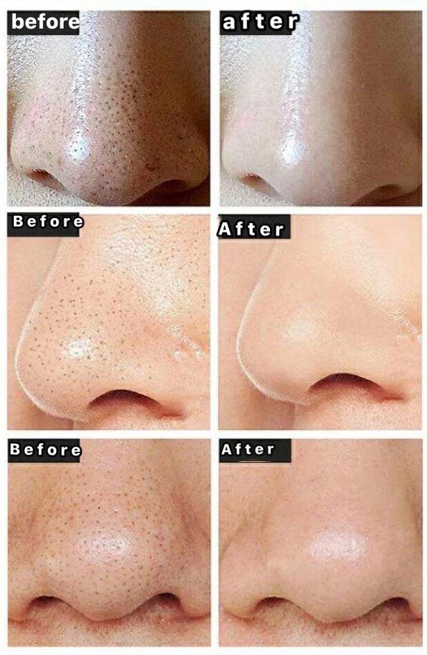 泰國🇹🇭OHO超強👍🏻清除黑頭收毛孔 磨砂粉(泰國熱銷🔥)掂👍🏻