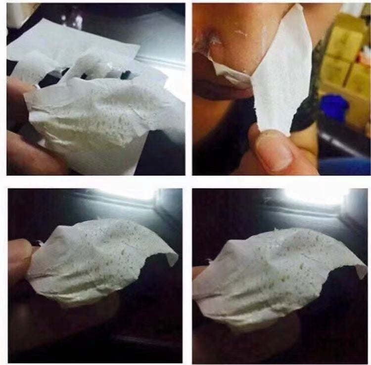 泰國快速🔜去黑頭水🍀