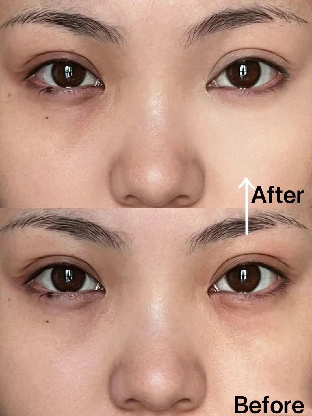 泰國🇹🇭TREE CHADA遮瑕液 ‼️‼️