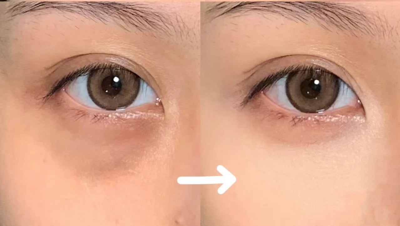 泰國🇹🇭TREE CHADA遮瑕液 ‼️‼️