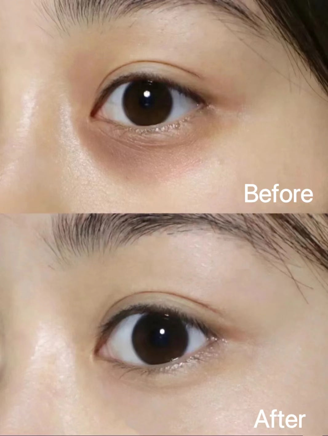 泰國🇹🇭Yanhee 針對黑眼圈凝膠