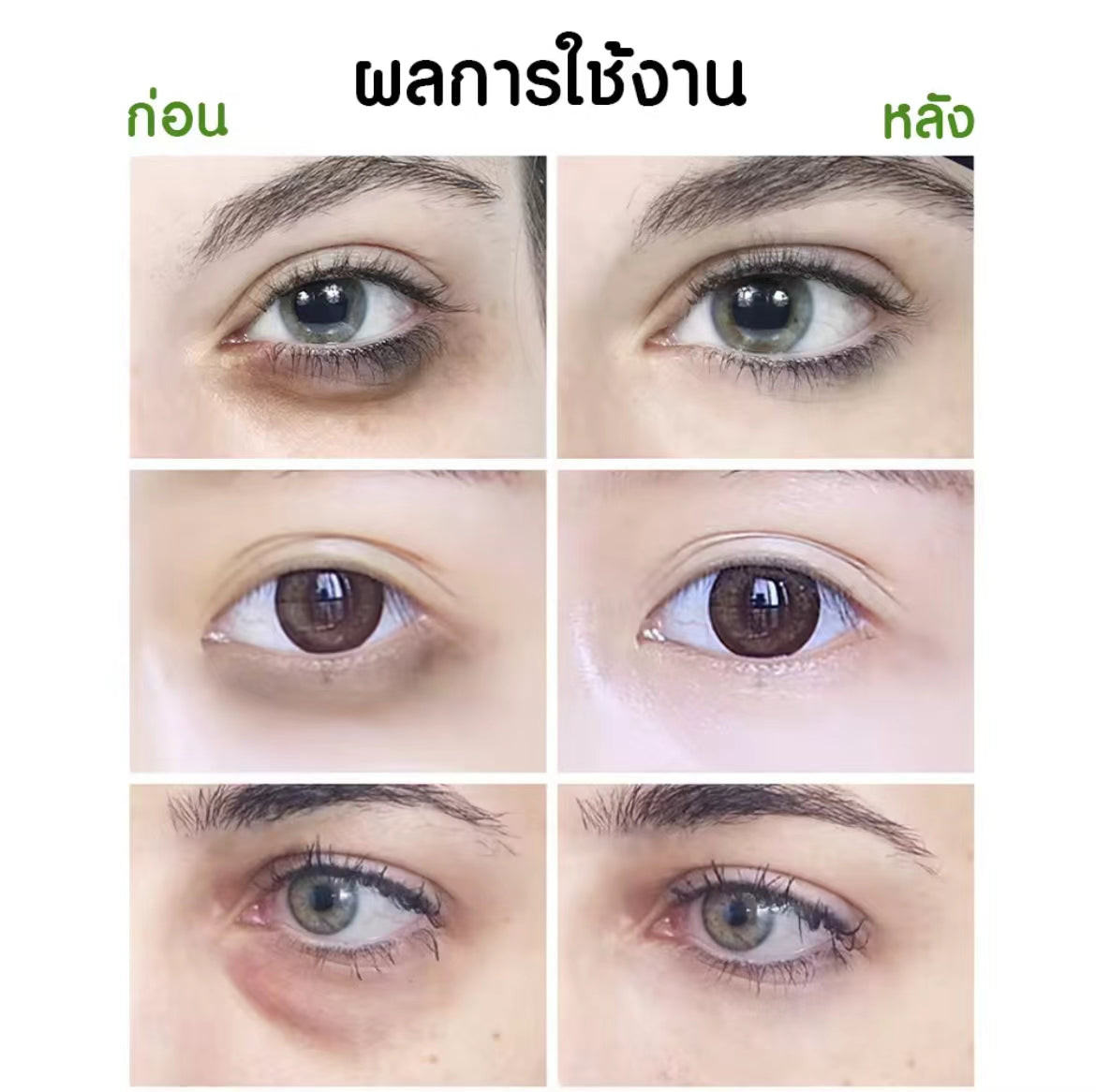 泰國🇹🇭Yanhee 針對黑眼圈凝膠