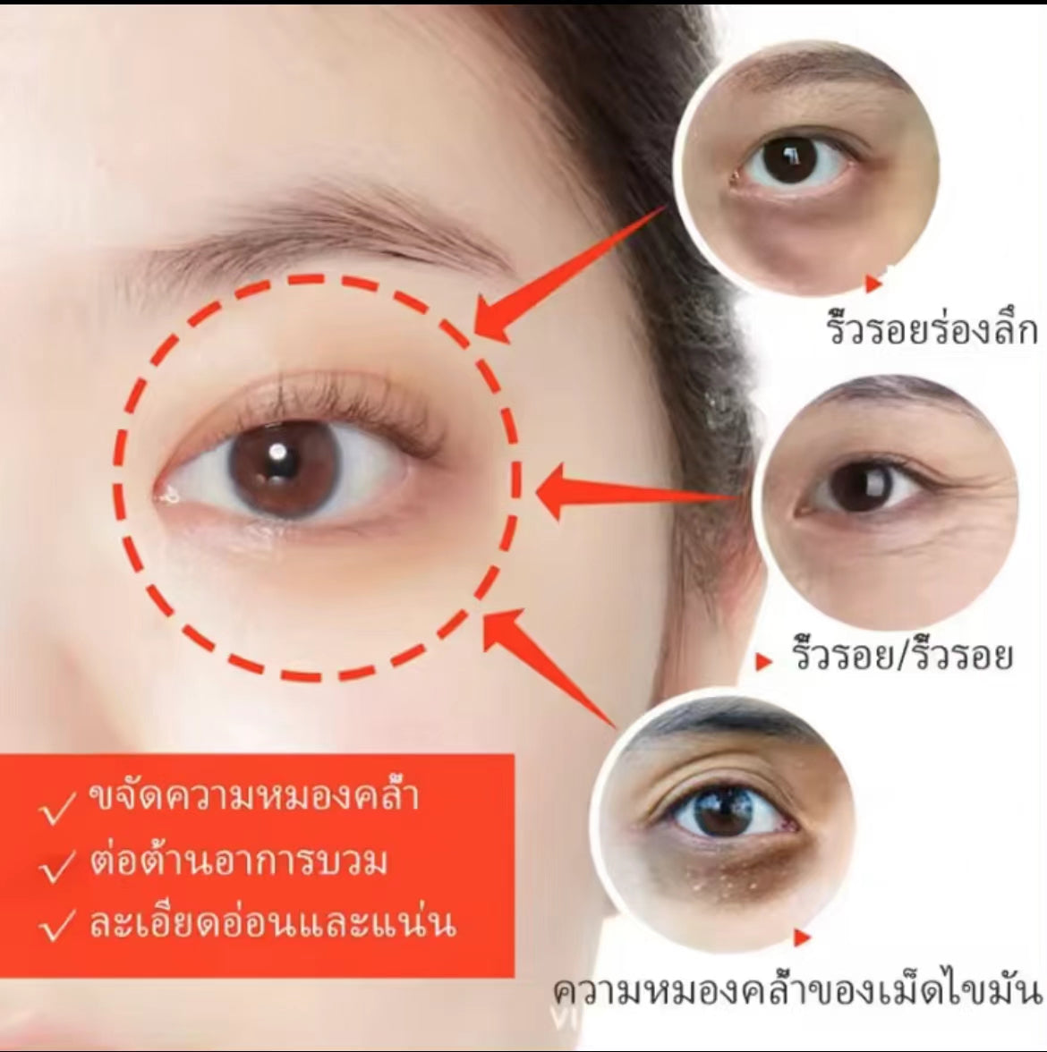 泰國🇹🇭Yanhee 針對黑眼圈凝膠