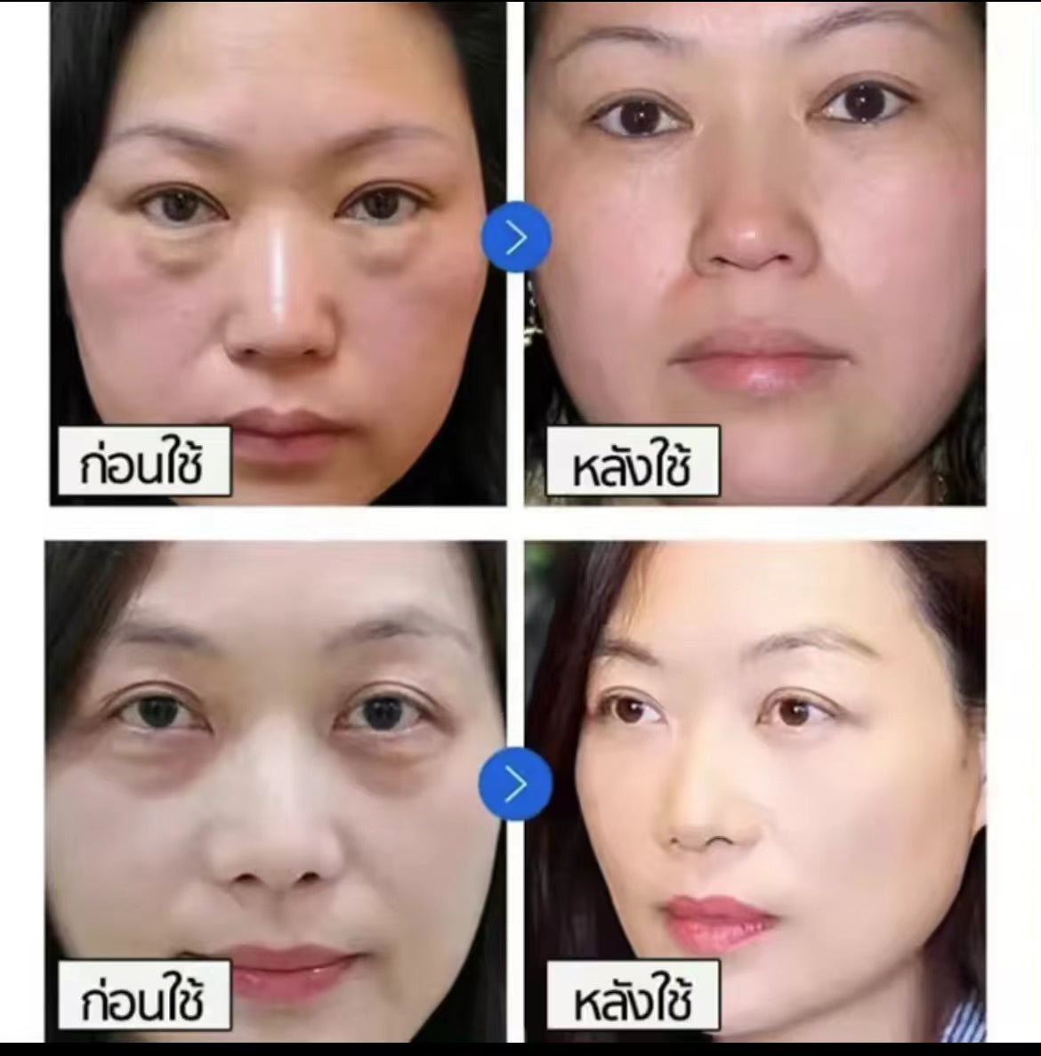 泰國🇹🇭Yanhee 針對黑眼圈凝膠