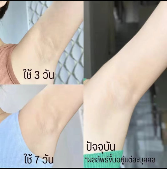 泰國🇹🇭Yanhee 腋下美白凝膠 醫用配方