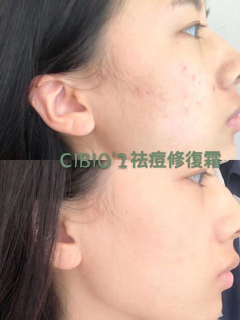 泰國🇹🇭CIBIO'2深海魚子快速嫩膚面膜