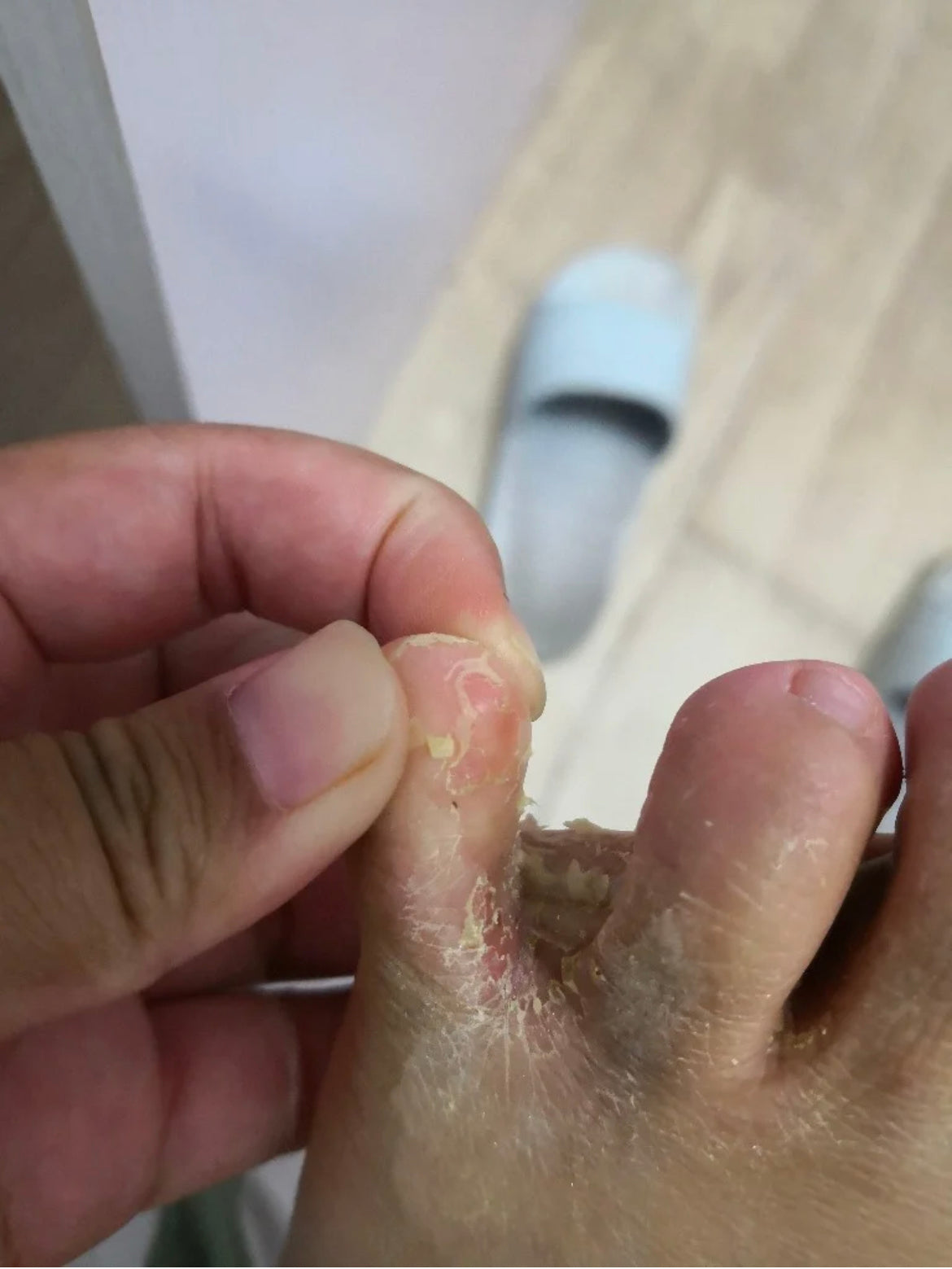 泰國🇹🇭用好的腳氣膏