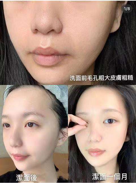 泰國🇹🇭深層潔面機❤️平價好用❤️