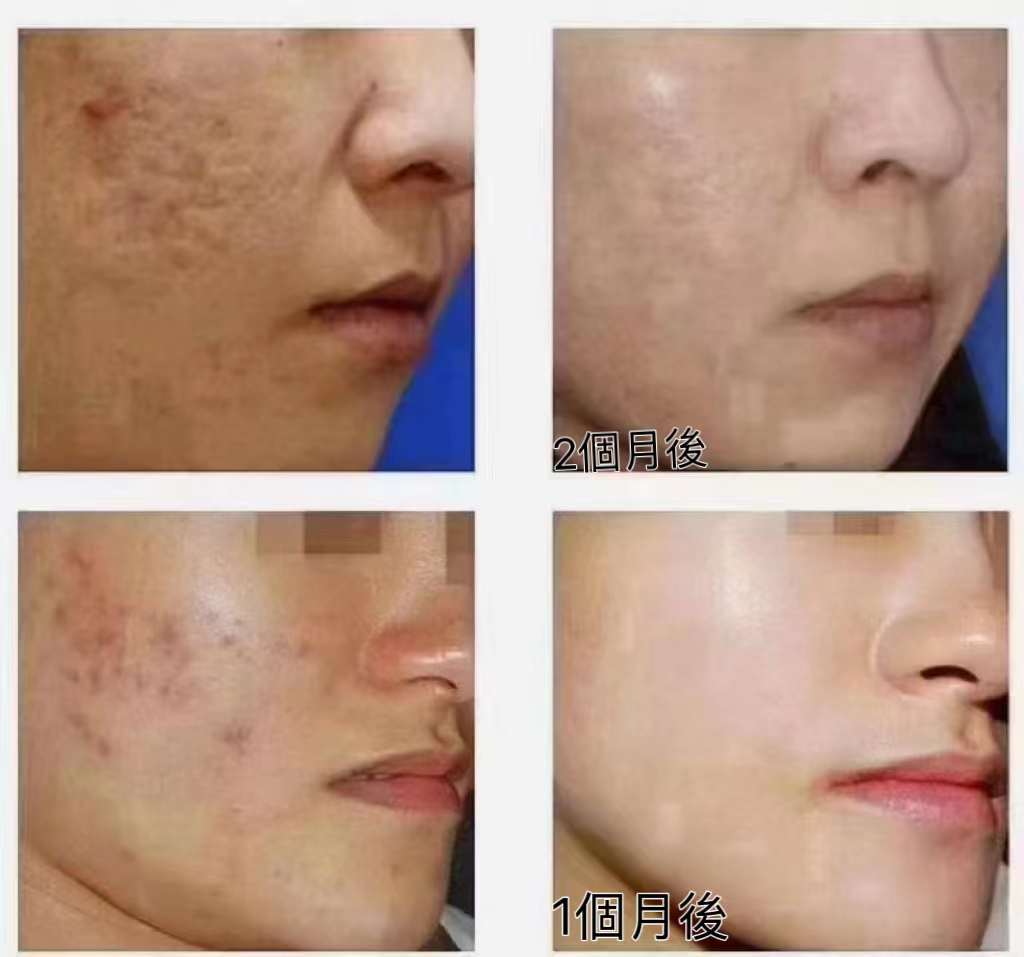 泰國🇹🇭PRECIOUS VIT VC🍋濃縮美白嫩膚面霜