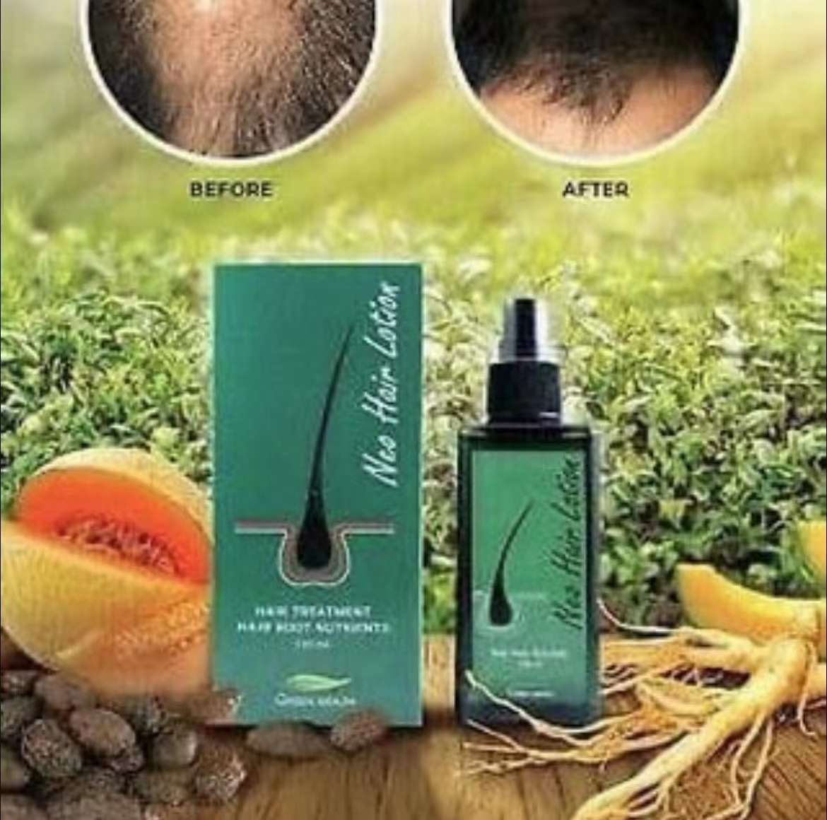 泰國🇹🇭Neo Hair 頭髮再生 生髮 防脫 營養液