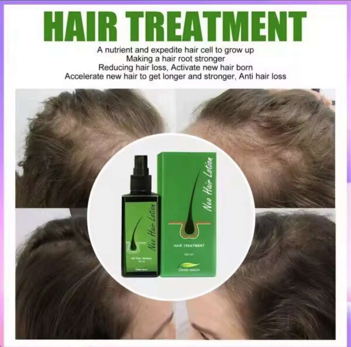 泰國🇹🇭Neo Hair 頭髮再生 生髮 防脫 營養液