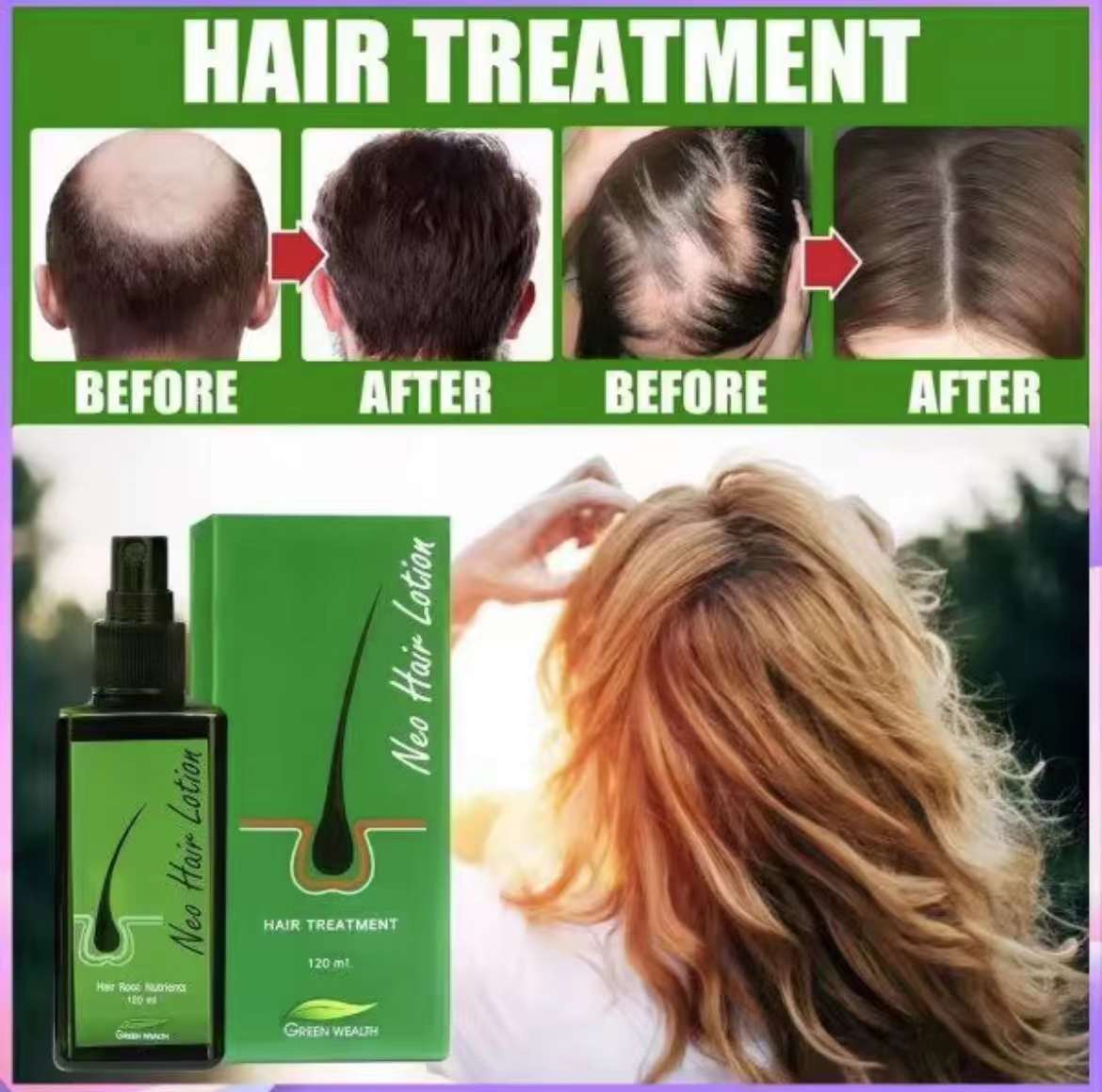 泰國🇹🇭Neo Hair 頭髮再生 生髮 防脫 營養液