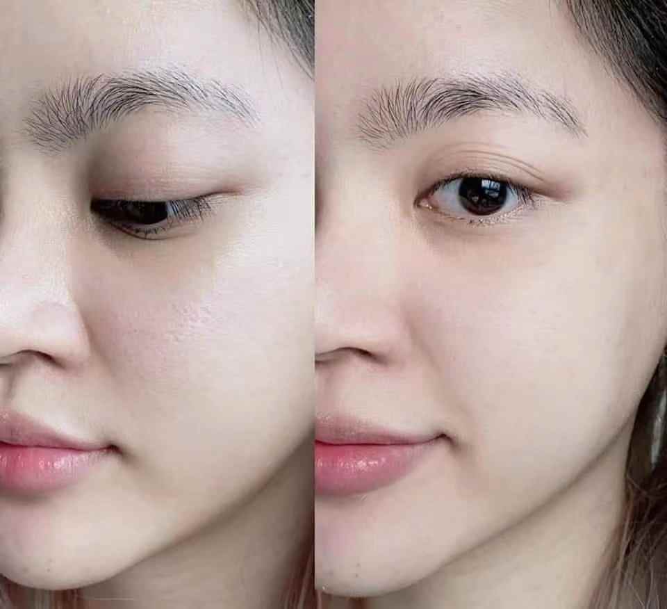 泰國Acne Sol Loose Powder (綠色) 敏感暗瘡皮膚專用碎粉