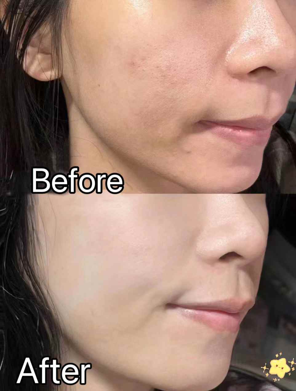 🎉泰國TREE CHADA 嫩白顏霜