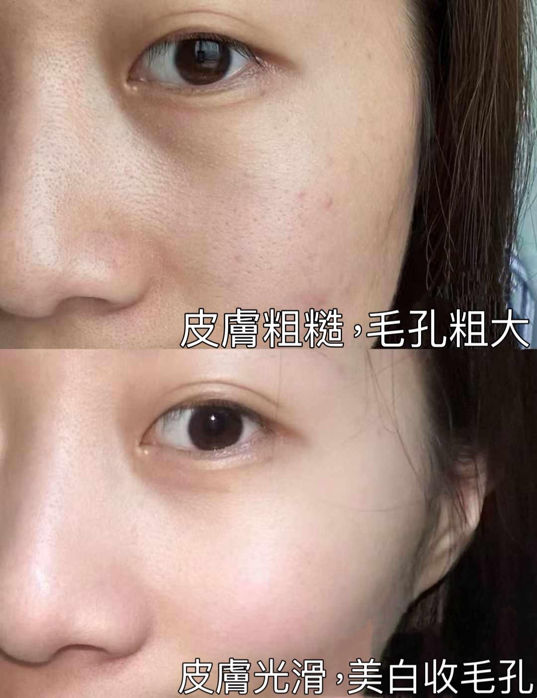 泰國皇家貴婦嫩膚美白童顏精華
💦