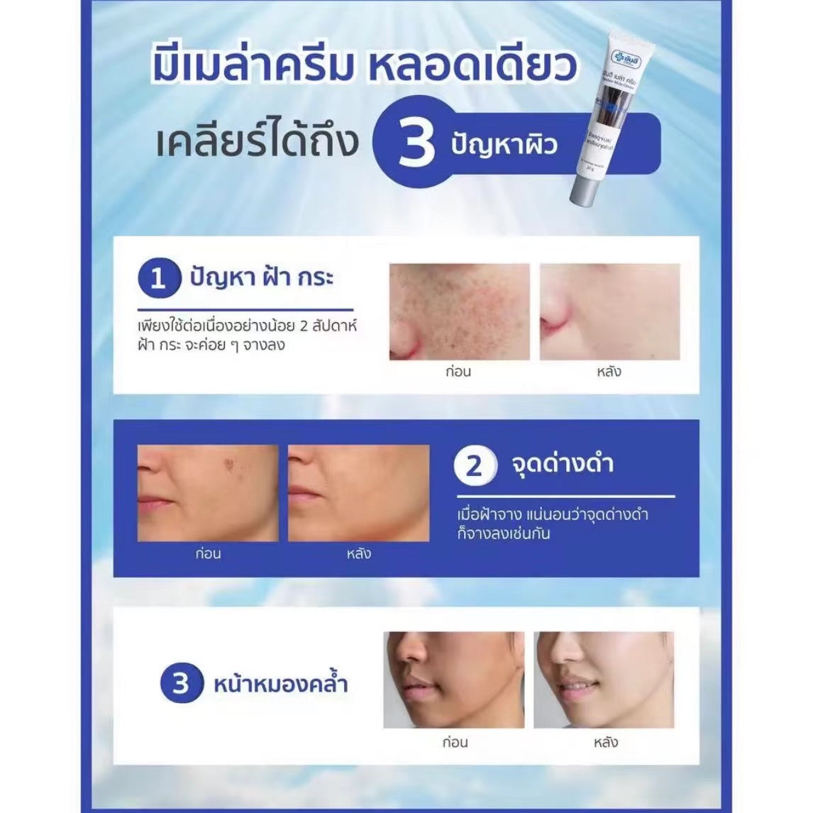 泰國🇹🇭超好用醫用Yanhee針對斑 黑斑 黃褐斑霜