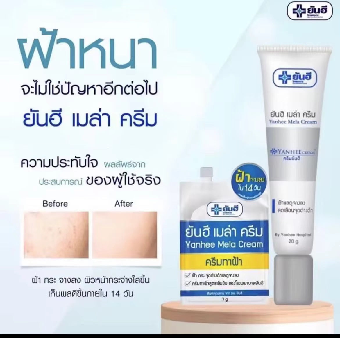 泰國🇹🇭超好用醫用Yanhee針對斑 黑斑 黃褐斑霜