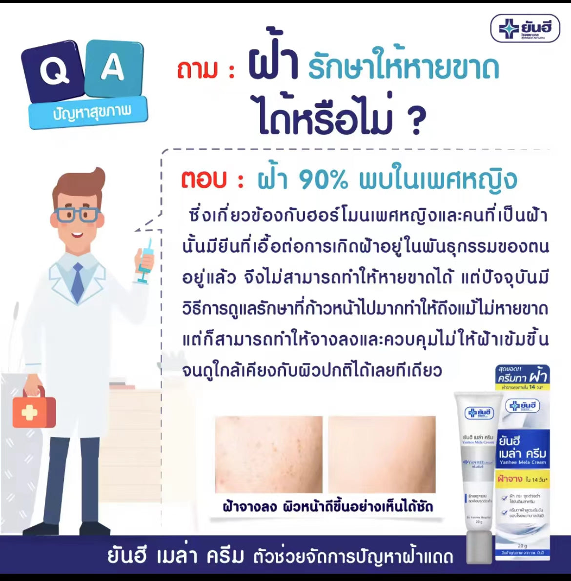 泰國🇹🇭超好用醫用Yanhee針對斑 黑斑 黃褐斑霜